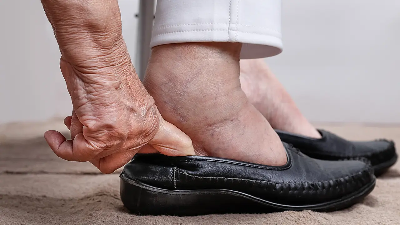 Close-up of an elderly person's hand and feet. The person is putting on black shoes. Their feet and ankles are swollen. 