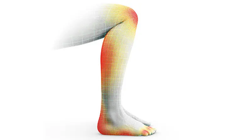 Textimg_LegAches2_DE