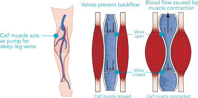 An illustration of the lower legs.