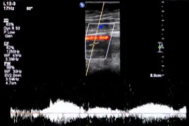 A screen showing increased blood flow after using Revitive
