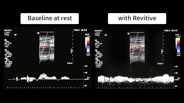 An image showing Revitive in action