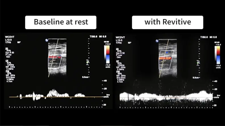 An image showing Revitive in action