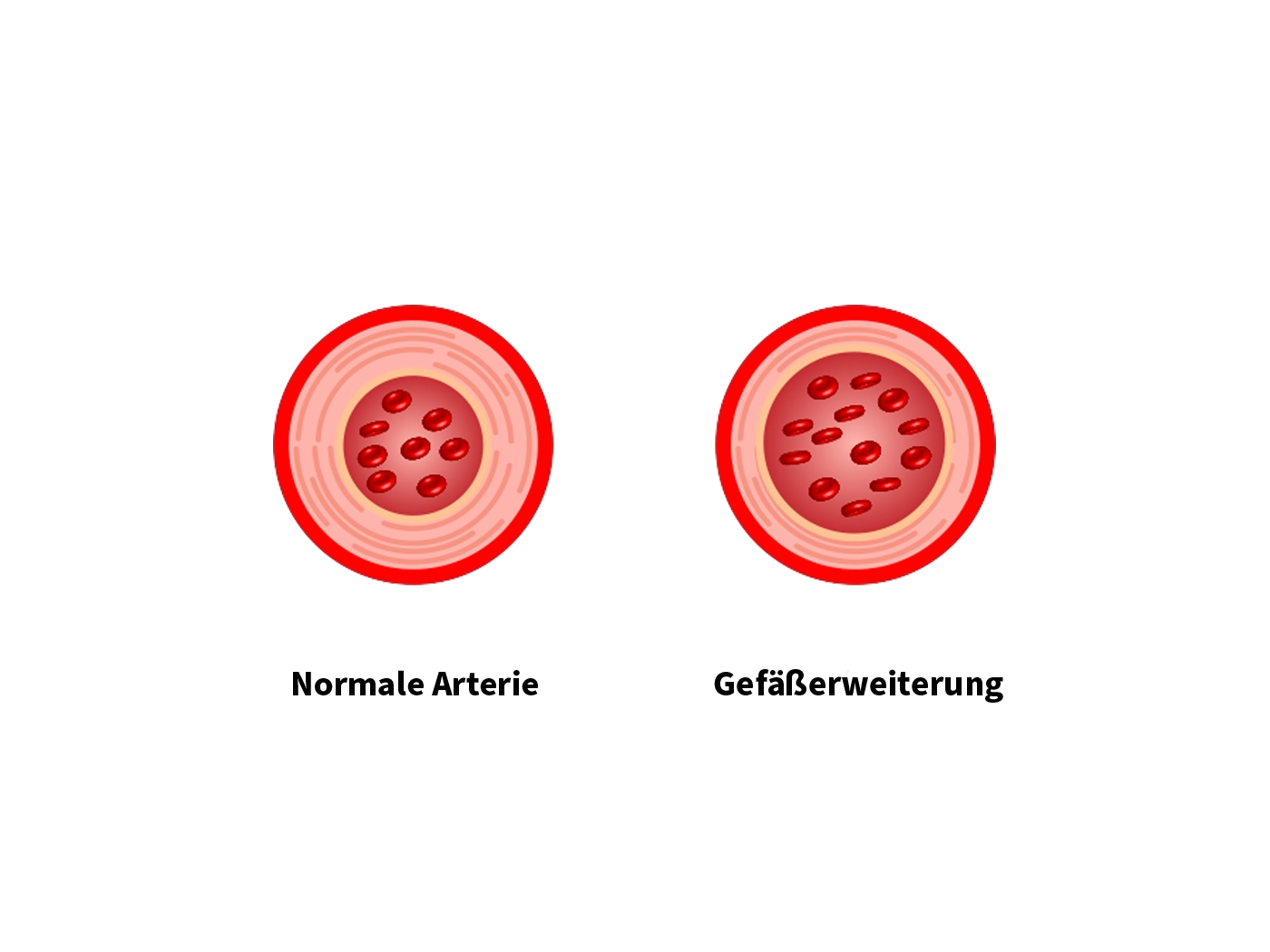 arteries_textimg_heavylegs_de