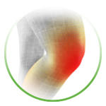 knee_pain